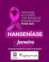 Janeiro Roxo: Mês de Conscientização sobre a Hanseníase Janeiro Roxo: Mês de Conscientização sobre a Hanseníase